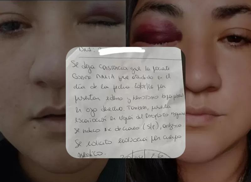 "Por si me termina de matar": una mujer de Berisso denunció a su expareja por un violento ataque