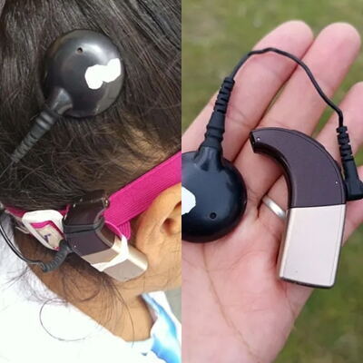 Familia de La Plata rifa su moto y su bicicleta para que su hija con hipoacusia pueda volver a escuchar