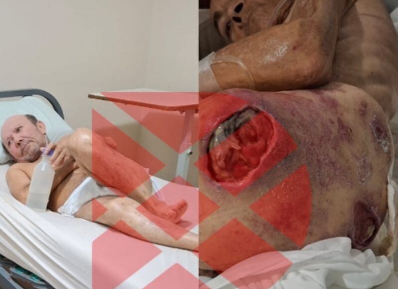 Escándalo nacional: abuelos cagados, meados y llenos de hormigas en una clínica de La Plata